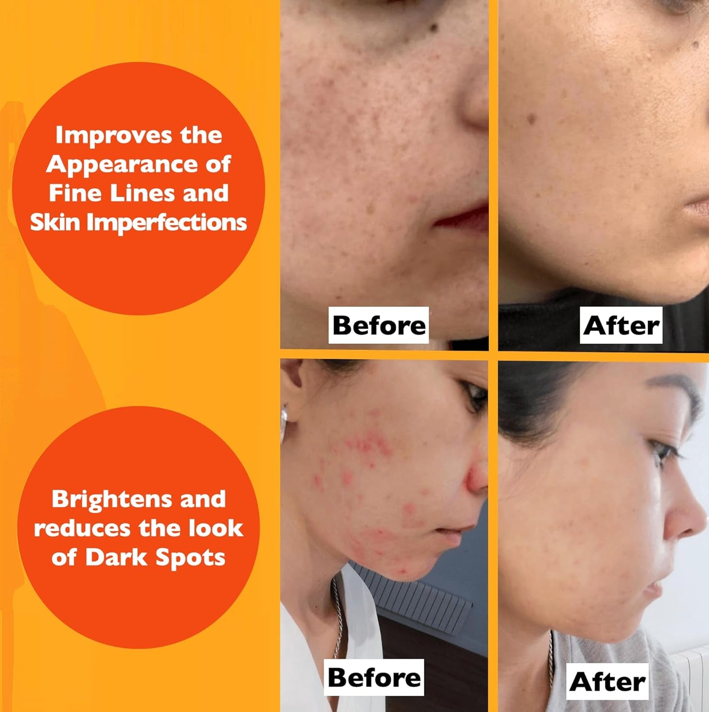 Vitamin C Serum For Face – Anti Aging Face Serum with Vitamin C, Hyaluronic Acid, Vitamin E. Brightening Formula. Improve Appearance of Dark Spots, Tone, Fine Lines & Wrinkles, Glowing Skin 2 Fl Oz Quick Pick Grocers