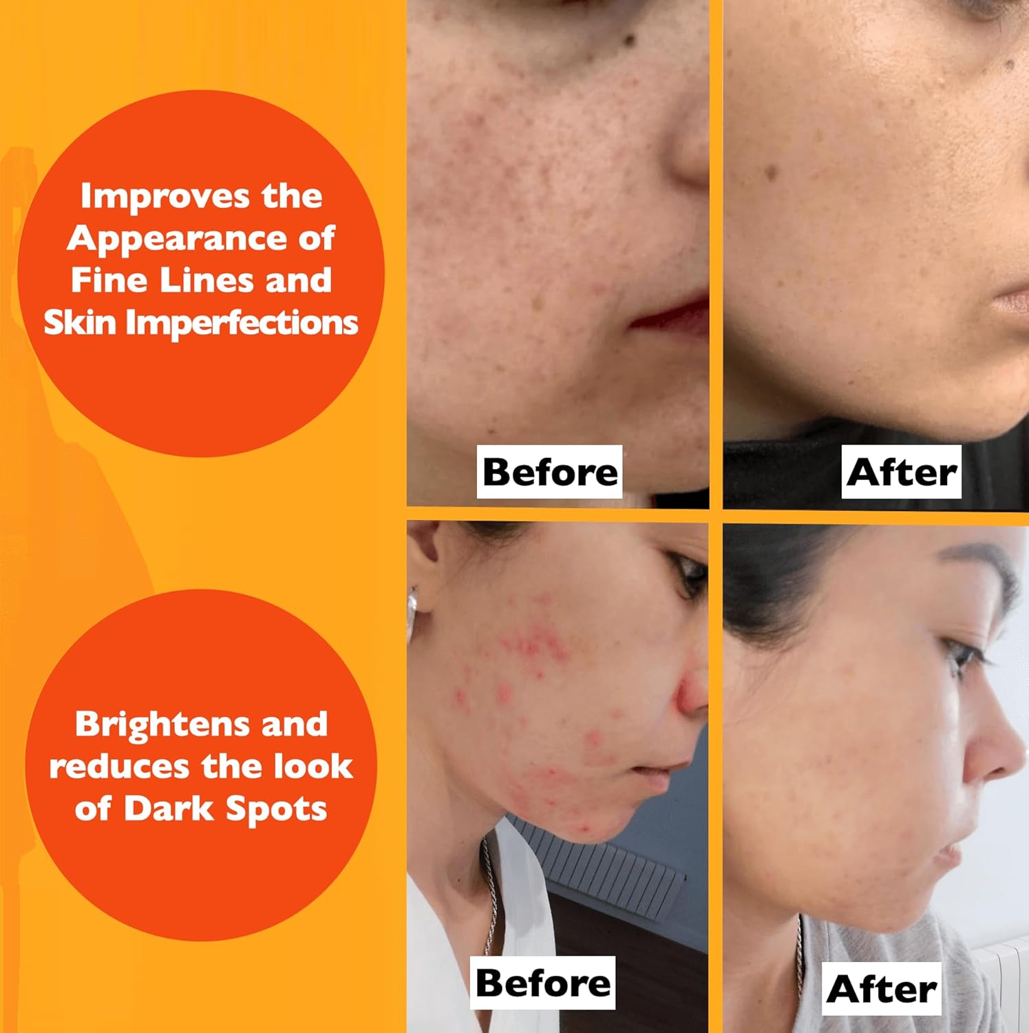 Vitamin C Serum For Face – Anti Aging Face Serum with Vitamin C, Hyaluronic Acid, Vitamin E. Brightening Formula. Improve Appearance of Dark Spots, Tone, Fine Lines & Wrinkles, Glowing Skin 2 Fl Oz Quick Pick Grocers