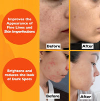 Vitamin C Serum For Face – Anti Aging Face Serum with Vitamin C, Hyaluronic Acid, Vitamin E. Brightening Formula. Improve Appearance of Dark Spots, Tone, Fine Lines & Wrinkles, Glowing Skin 2 Fl Oz Quick Pick Grocers