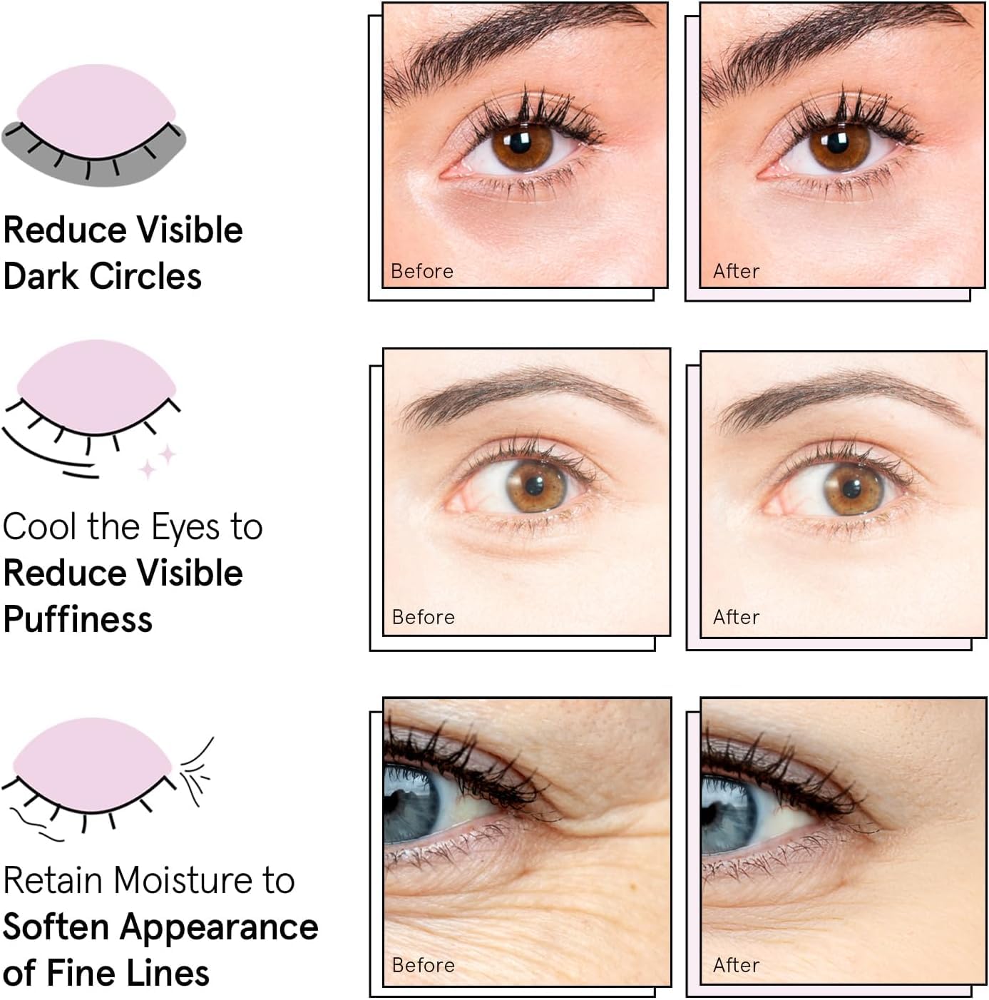 grace & stella Award Winning Under Eye Mask Reduce Dark Circles, Puffy Eyes, Undereye Bags, Wrinkles, Gel Under Eye Patches, Get Well Gifts for Women Quick Pick Grocers