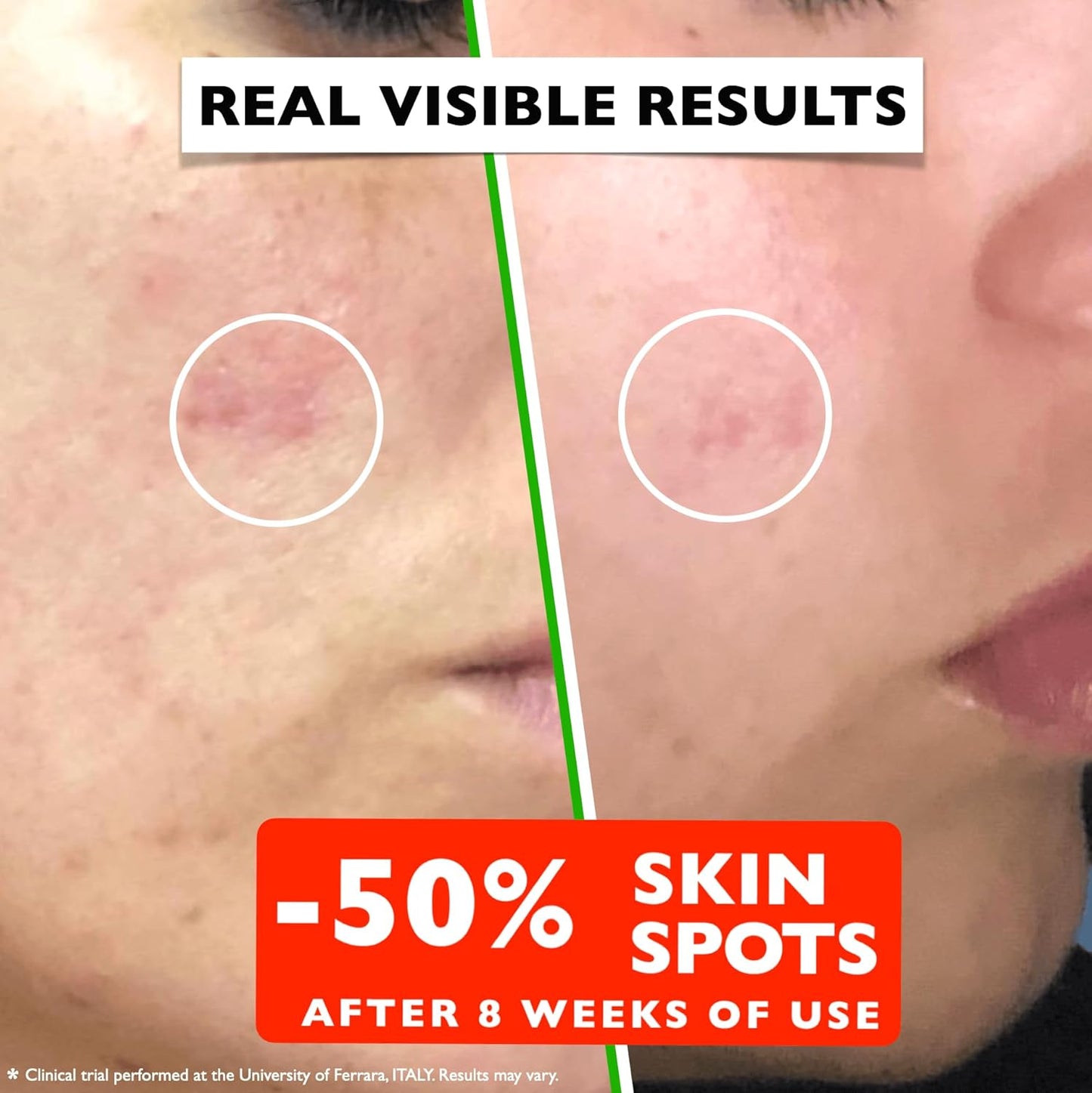 Vitamin C Serum For Face – Anti Aging Face Serum with Vitamin C, Hyaluronic Acid, Vitamin E. Brightening Formula. Improve Appearance of Dark Spots, Tone, Fine Lines & Wrinkles, Glowing Skin 2 Fl Oz Quick Pick Grocers