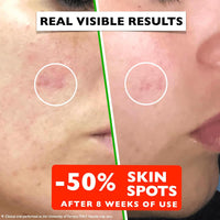 Vitamin C Serum For Face – Anti Aging Face Serum with Vitamin C, Hyaluronic Acid, Vitamin E. Brightening Formula. Improve Appearance of Dark Spots, Tone, Fine Lines & Wrinkles, Glowing Skin 2 Fl Oz Quick Pick Grocers