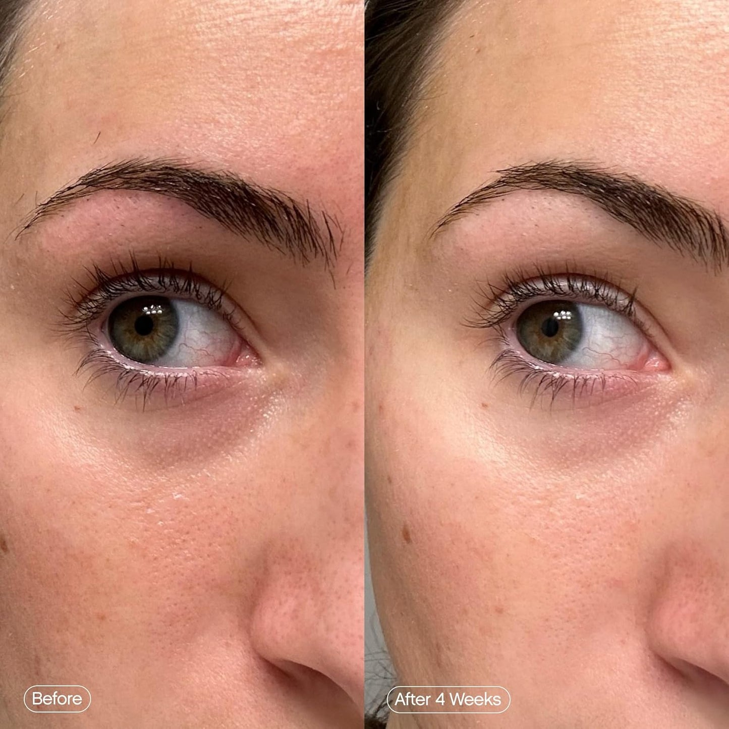 Topicals Faded Brightening Under Eye Masks | Patches to Depuff, Hydrate, Brighten and Cool | Reduce Dark Circles and Fine Lines | Contains Kojic Acid, Caffeine and Niacinamide (Set of 6) Quick Pick Grocers