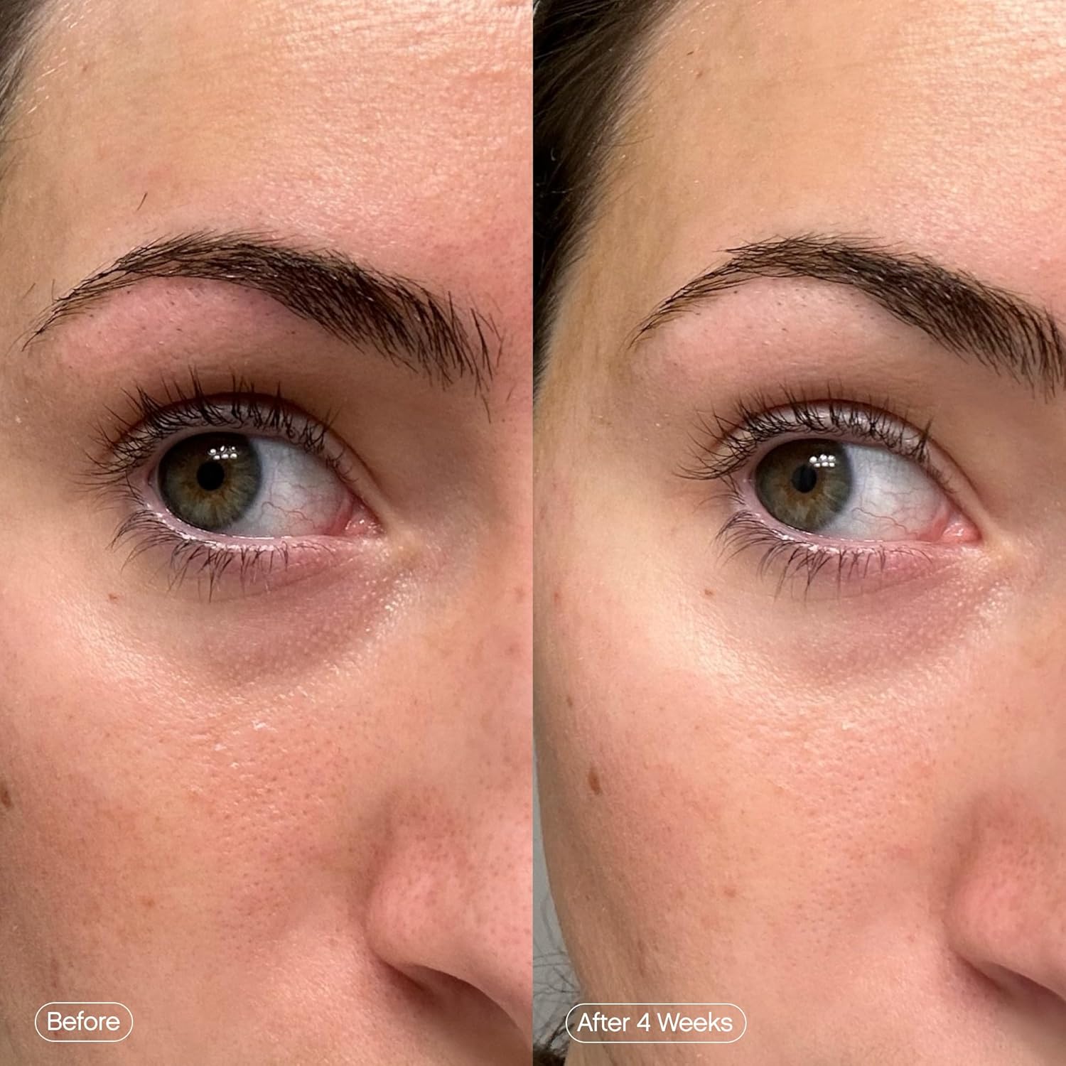 Topicals Faded Brightening Under Eye Masks | Patches to Depuff, Hydrate, Brighten and Cool | Reduce Dark Circles and Fine Lines | Contains Kojic Acid, Caffeine and Niacinamide (Set of 6) Quick Pick Grocers