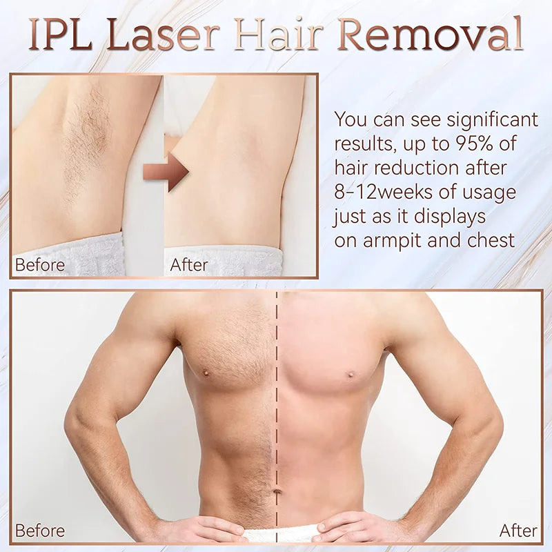 999999 Flashes IPL Laser Epilator for Women Home Use Devices Hair Removal Painless Electric Epilator Bikini Dropshipping Econic Blanks