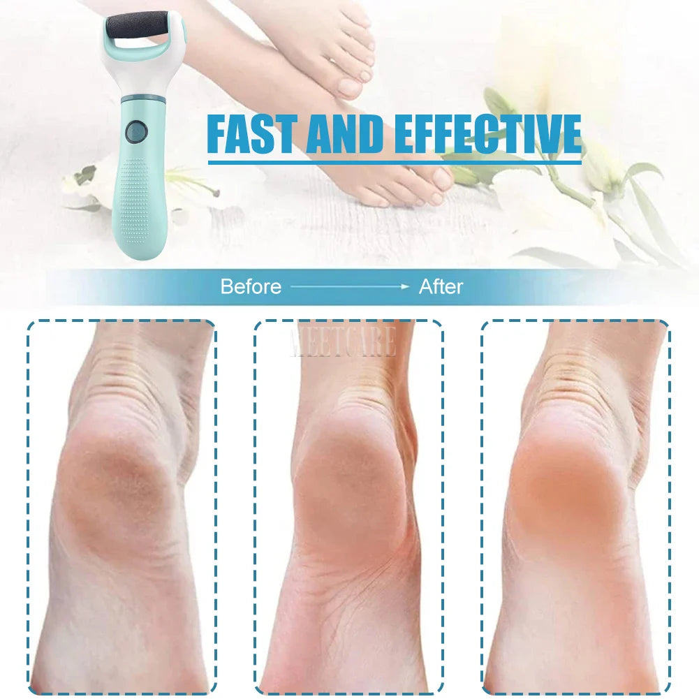Electric Foot Grinder Dead Skin Remover Feet Scrubber Callus Pedicure Shaver Remove Dry Dead Cracked Safe Foot Care Repair Purest Peak
